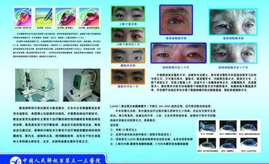 医院眼科图版图片PSD源文件免费下载(图片编号:3281535)_六图网16pic.com