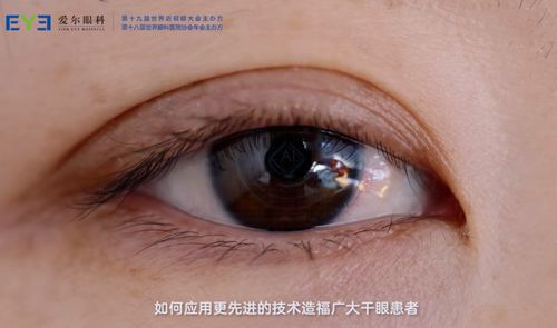 爱尔眼科疑难干眼症诊疗中心覆盖全国,打通全链路诊疗流程与服务
